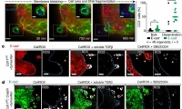 Nature：研究发现E-钙粘蛋白是多种乳腺癌转移必需的蛋白质！