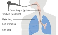 Nature医学：肺癌早期诊断迎来新突破！有望在发病前就进行诊治
