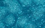 Cell Stem Cell：科学家发现体细胞逆转为干细胞的“开关”