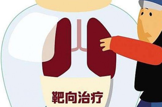 新一代ALK阳性转移性非小细胞肺癌靶向药获批